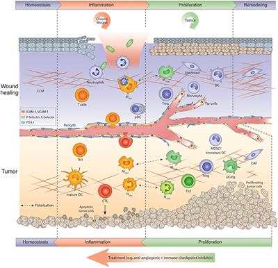 Tumors vs. Chronic Wounds: An Immune Cell's Perspective